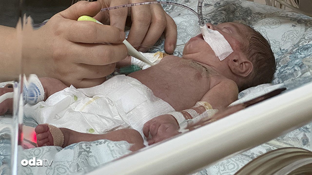 bir yenidogan skandali daha ilacla erken dogum mhNgxLsk